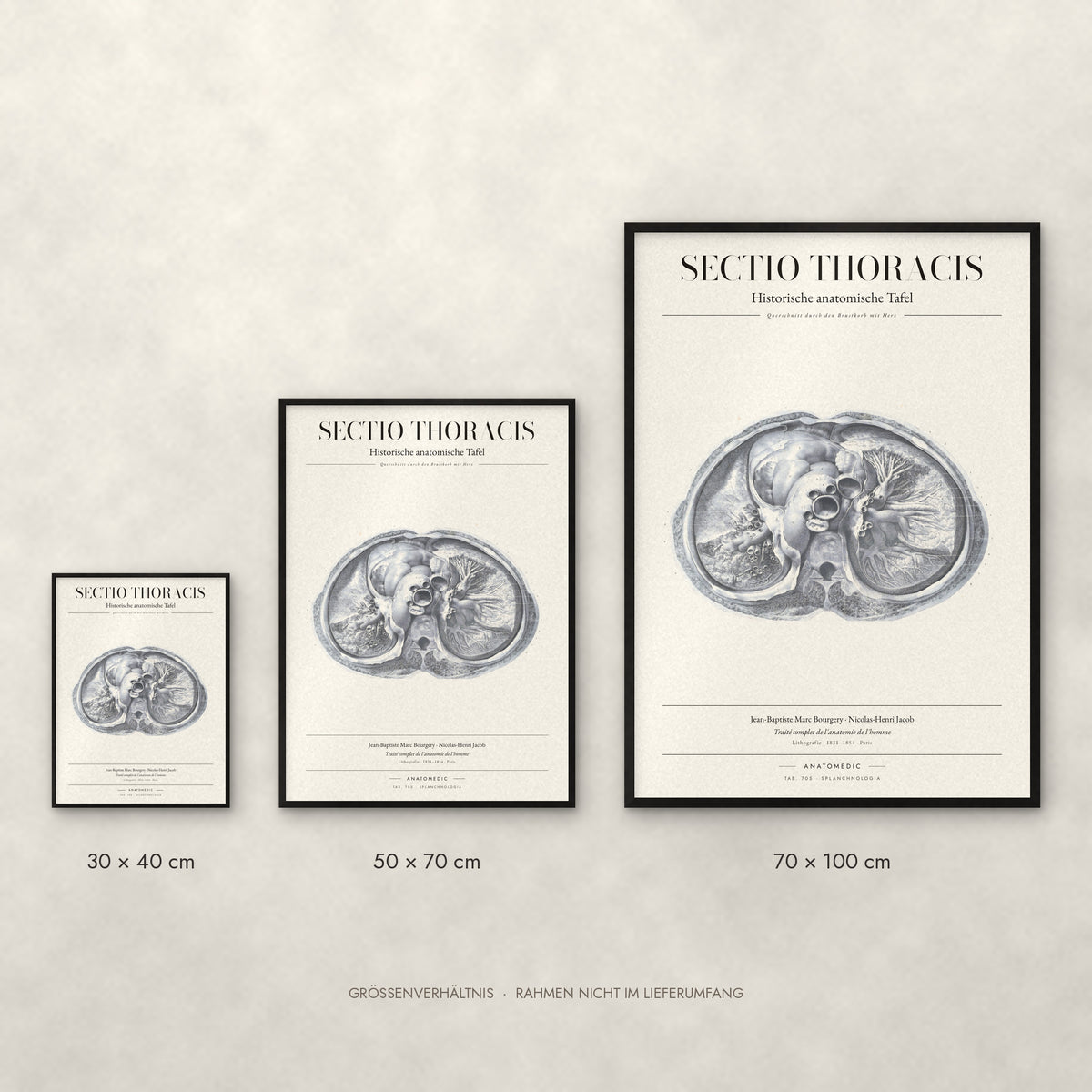 Sectio Thoracis Poster im Größenvergleich: 30 × 40, 50 × 70 und 70 × 100 cm