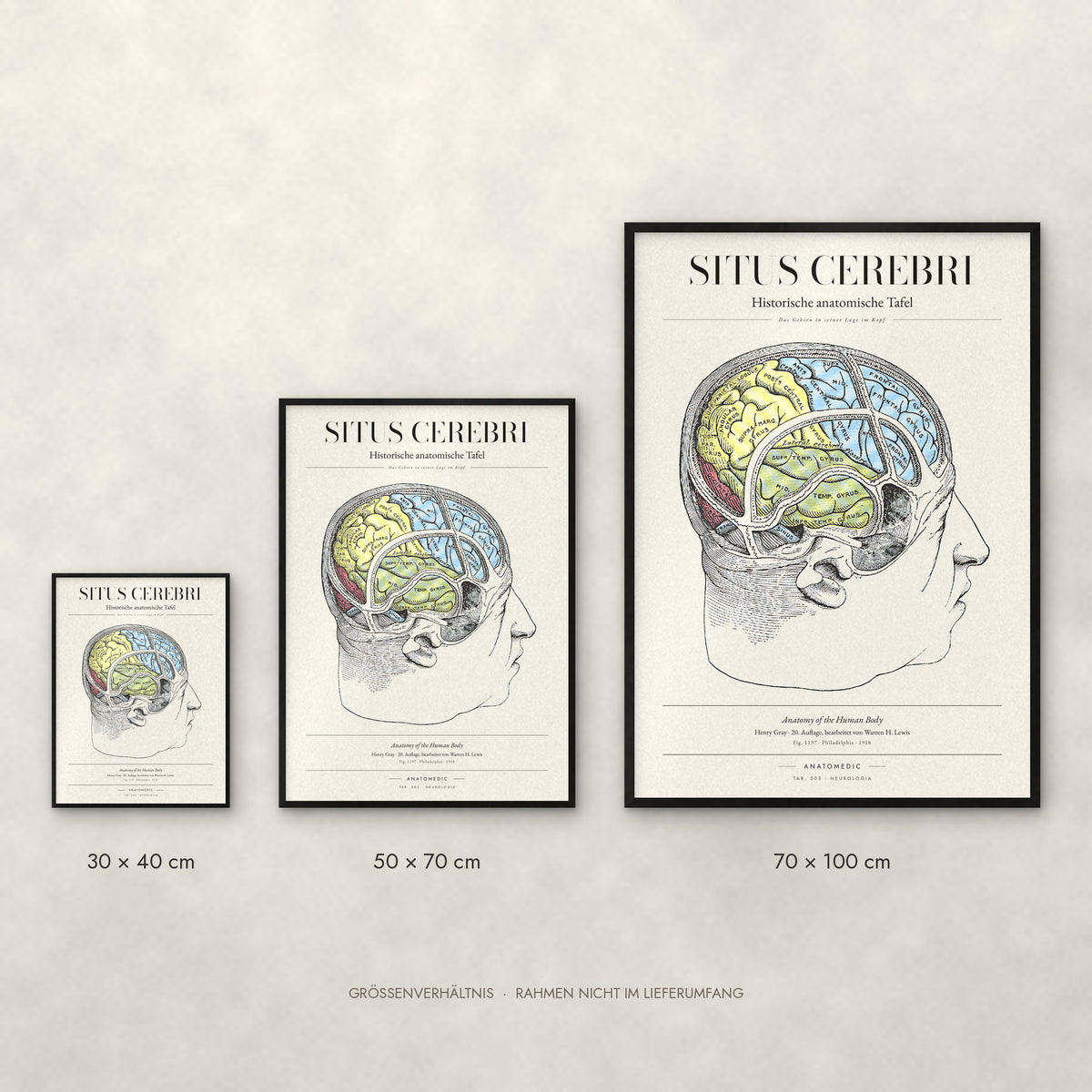 Situs Cerebri Poster im Größenvergleich: 30 × 40, 50 × 70 und 70 × 100 cm