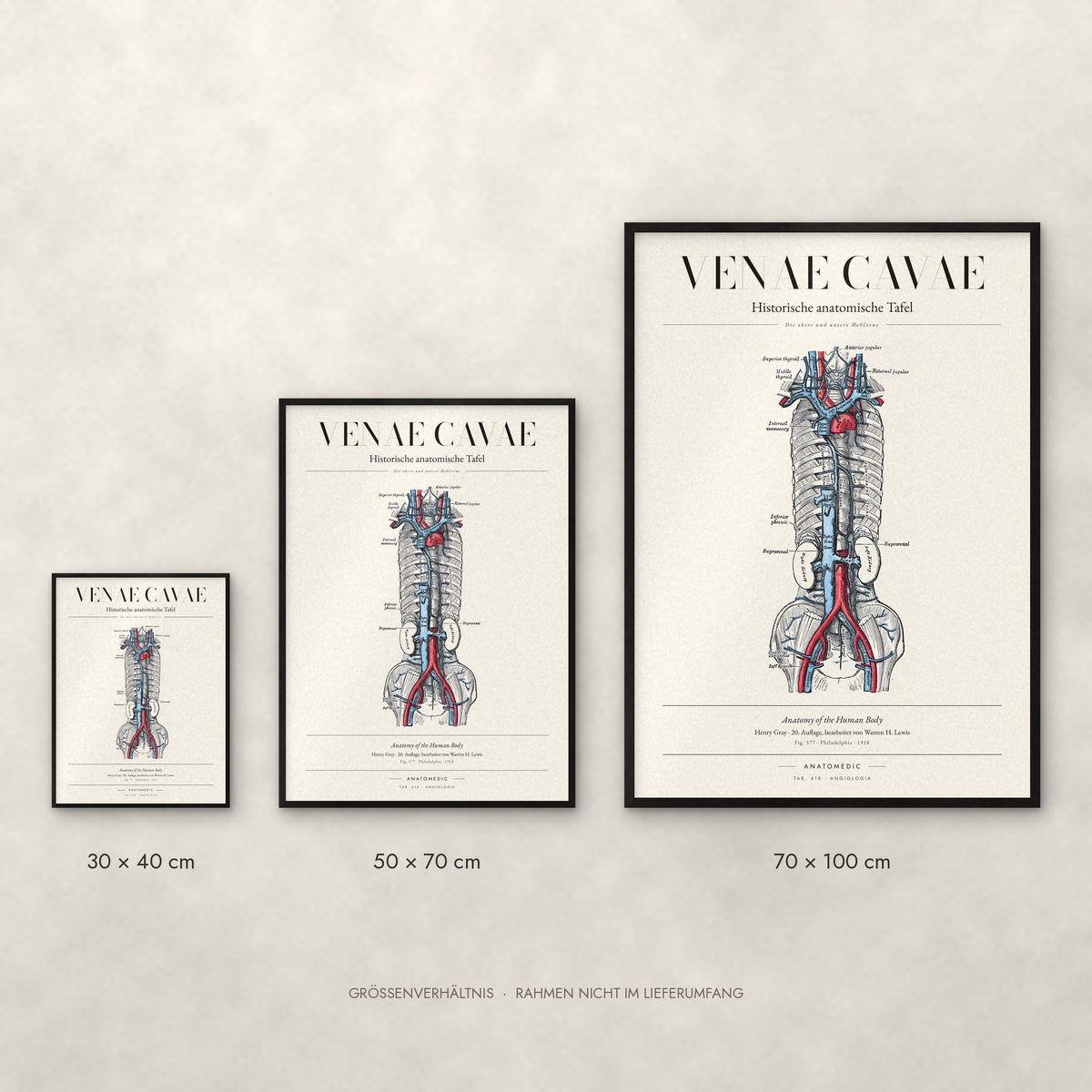 Venae Cavae Poster im Größenvergleich: 30 × 40, 50 × 70 und 70 × 100 cm