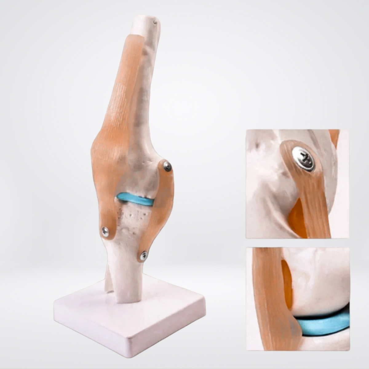 Funktionelles Anatomiemodell des Knies, Detailansicht - anatomedic