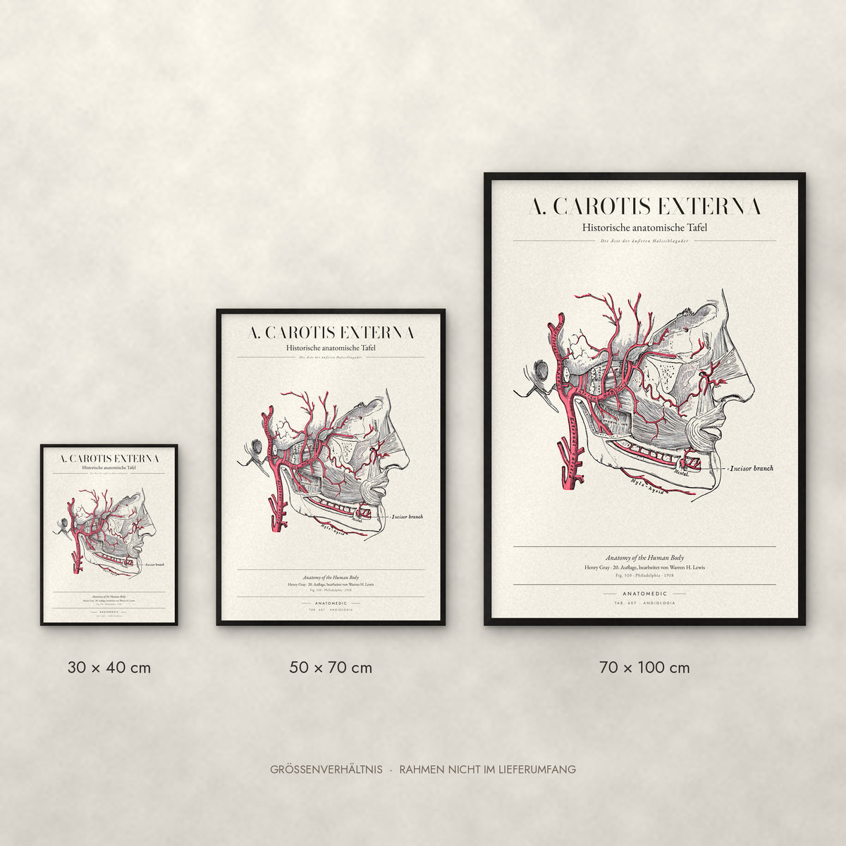 A. Carotis Externa Poster im Größenvergleich: 30 × 40, 50 × 70 und 70 × 100 cm