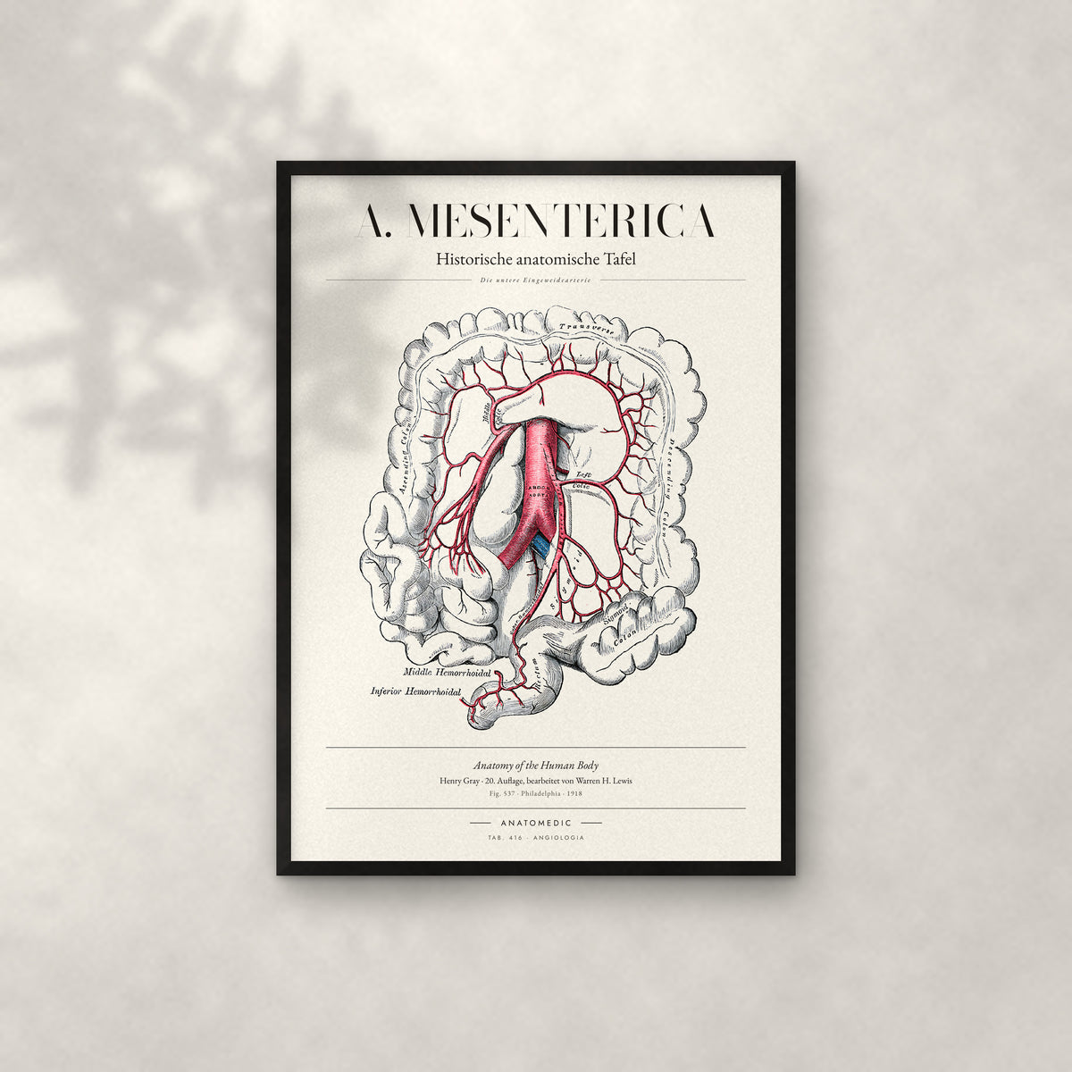 A. Mesenterica – Die untere Eingeweidearterie Anatomie-Poster im schwarzen Rahmen an heller Wand