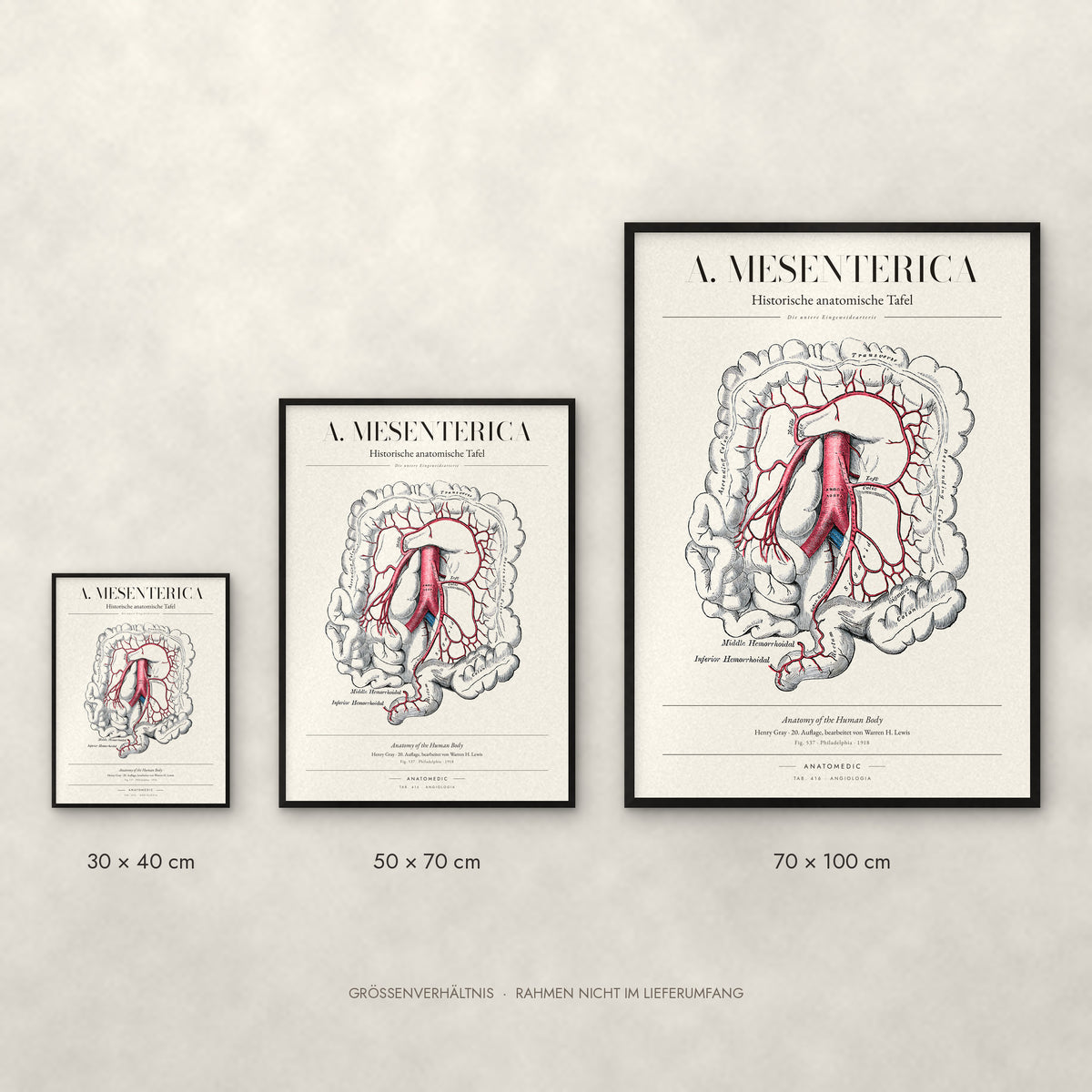 A. Mesenterica – Die untere Eingeweidearterie Poster im Größenvergleich: 30 × 40, 50 × 70 und 70 × 100 cm