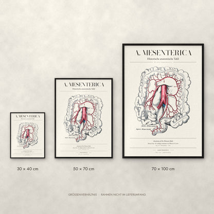 A. Mesenterica – Die untere Eingeweidearterie Poster im Größenvergleich: 30 × 40, 50 × 70 und 70 × 100 cm