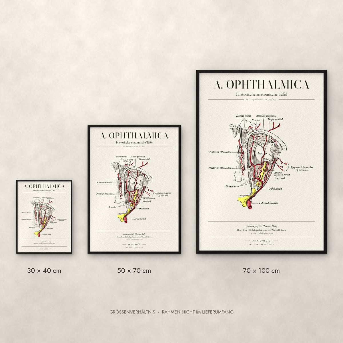 A. Ophthalmica Poster im Größenvergleich: 30 × 40, 50 × 70 und 70 × 100 cm