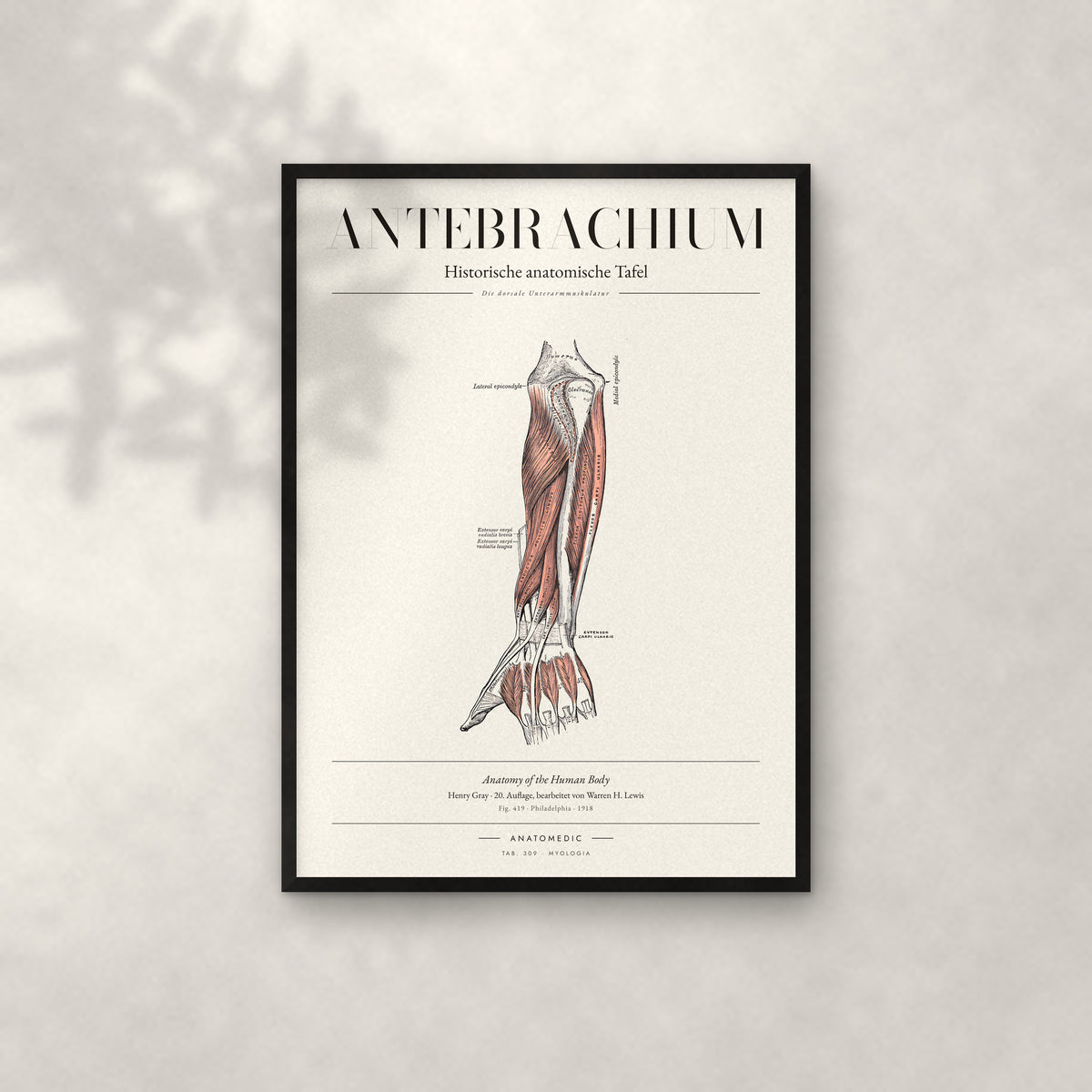 Antebrachium – Die dorsale Unterarmmuskulatur Anatomie-Poster im schwarzen Rahmen an heller Wand