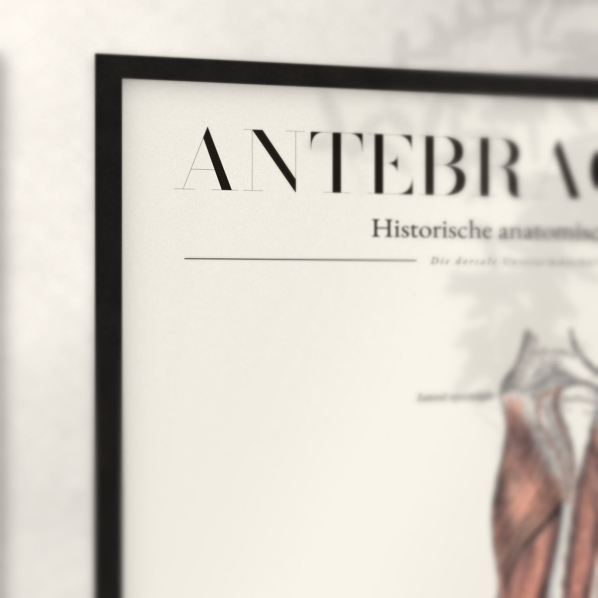 Nahaufnahme von Rahmenecke und Titel „Antebrachium – Die dorsale Unterarmmuskulatur“