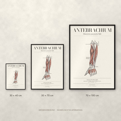 Antebrachium – Die dorsale Unterarmmuskulatur Poster im Größenvergleich: 30 × 40, 50 × 70 und 70 × 100 cm