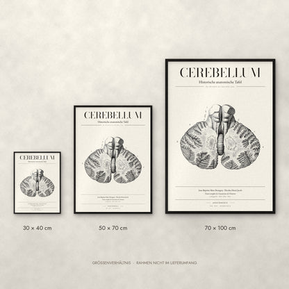 Cerebellum Poster im Größenvergleich: 30 × 40, 50 × 70 und 70 × 100 cm