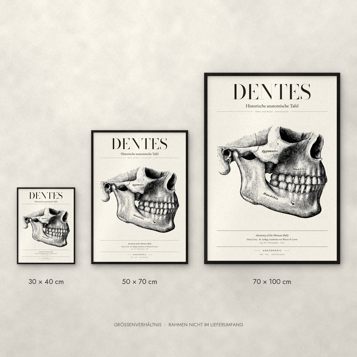 Dentes Poster im Größenvergleich: 30 × 40, 50 × 70 und 70 × 100 cm
