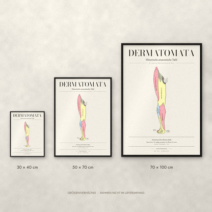 Dermatomata Poster im Größenvergleich: 30 × 40, 50 × 70 und 70 × 100 cm