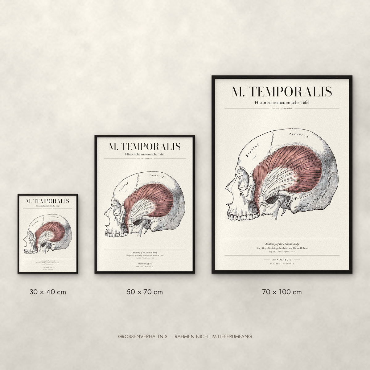 M. Temporalis Poster im Größenvergleich: 30 × 40, 50 × 70 und 70 × 100 cm