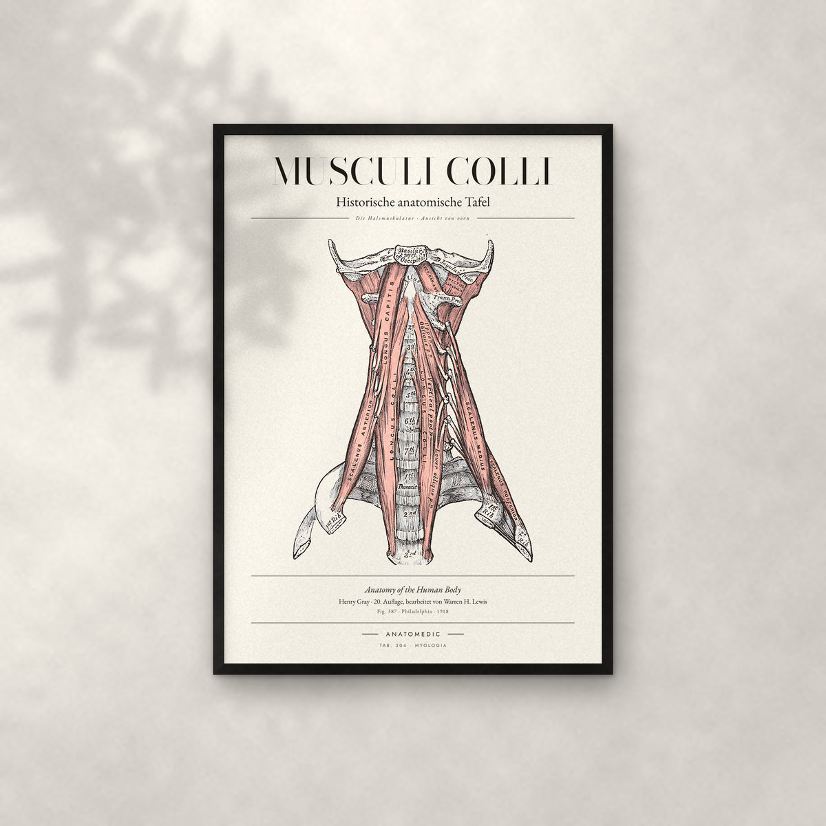 Musculi Colli – Die Halsmuskulatur · Ansicht von vorn Anatomie-Poster im schwarzen Rahmen an heller Wand
