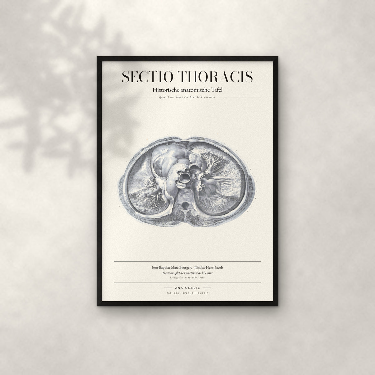 Sectio Thoracis Anatomie-Poster im schwarzen Rahmen an heller Wand