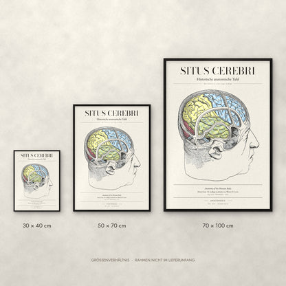 Situs Cerebri Poster im Größenvergleich: 30 × 40, 50 × 70 und 70 × 100 cm