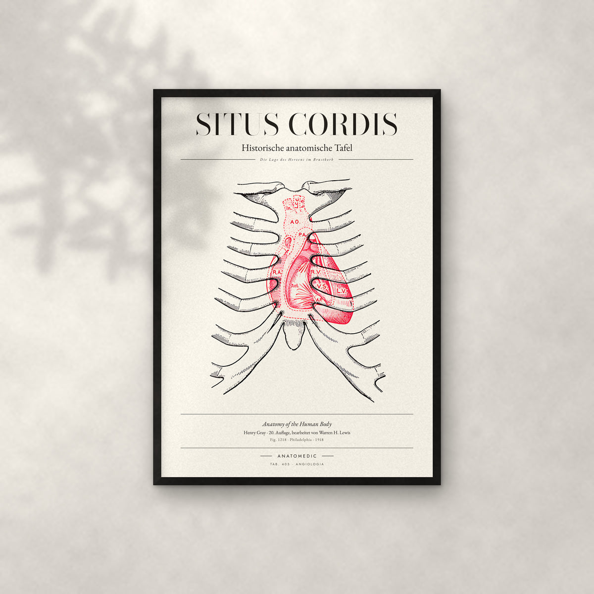 Situs Cordis Anatomie-Poster im schwarzen Rahmen an heller Wand