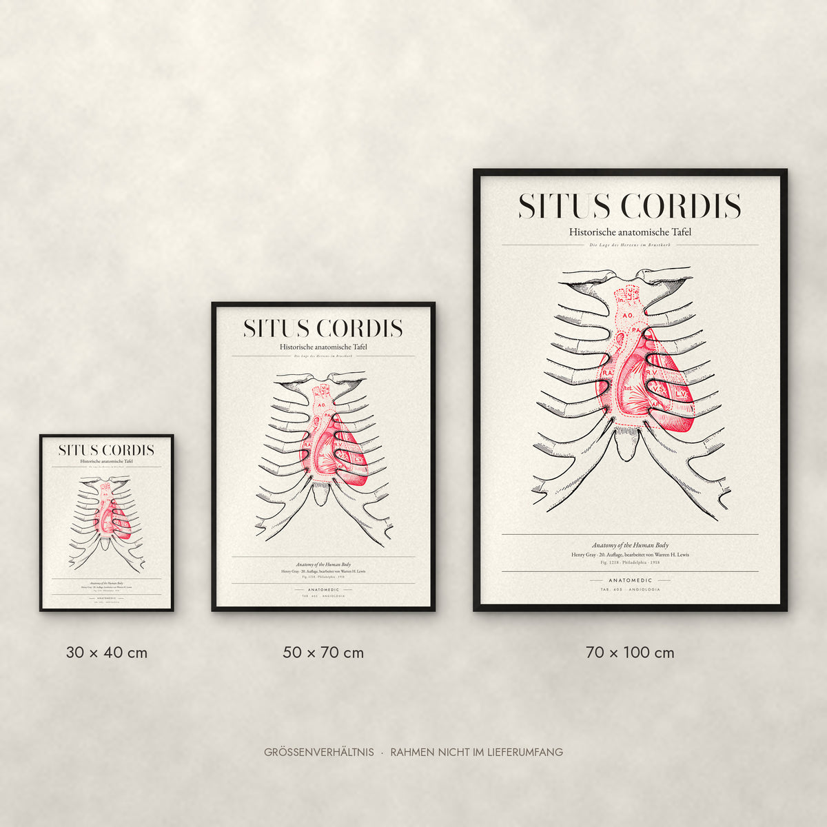 Situs Cordis Poster im Größenvergleich: 30 × 40, 50 × 70 und 70 × 100 cm