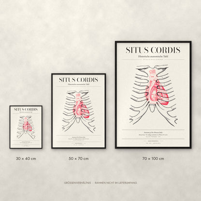 Situs Cordis Poster im Größenvergleich: 30 × 40, 50 × 70 und 70 × 100 cm
