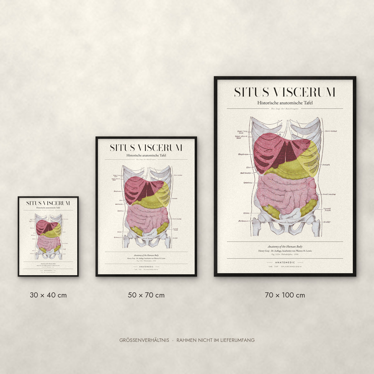 Situs Viscerum Poster im Größenvergleich: 30 × 40, 50 × 70 und 70 × 100 cm
