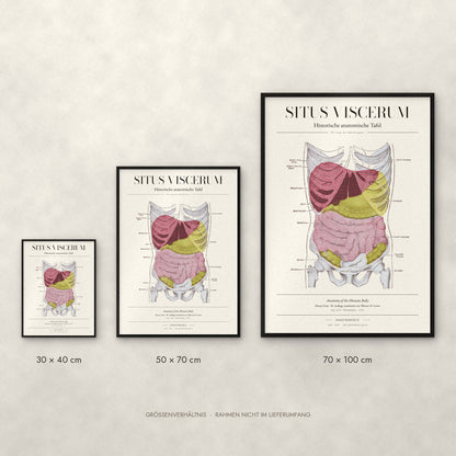 Situs Viscerum Poster im Größenvergleich: 30 × 40, 50 × 70 und 70 × 100 cm