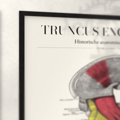 Nahaufnahme von Rahmenecke und Titel „Truncus Encephali“