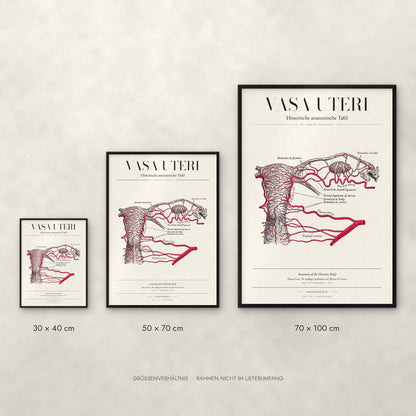 Vasa Uteri Poster im Größenvergleich: 30 × 40, 50 × 70 und 70 × 100 cm