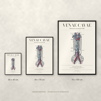 Venae Cavae Poster im Größenvergleich: 30 × 40, 50 × 70 und 70 × 100 cm